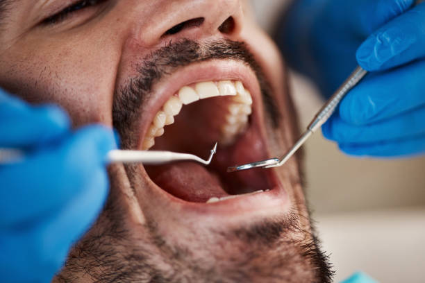 Best Mobile Emergency Dentist in Dover, NH